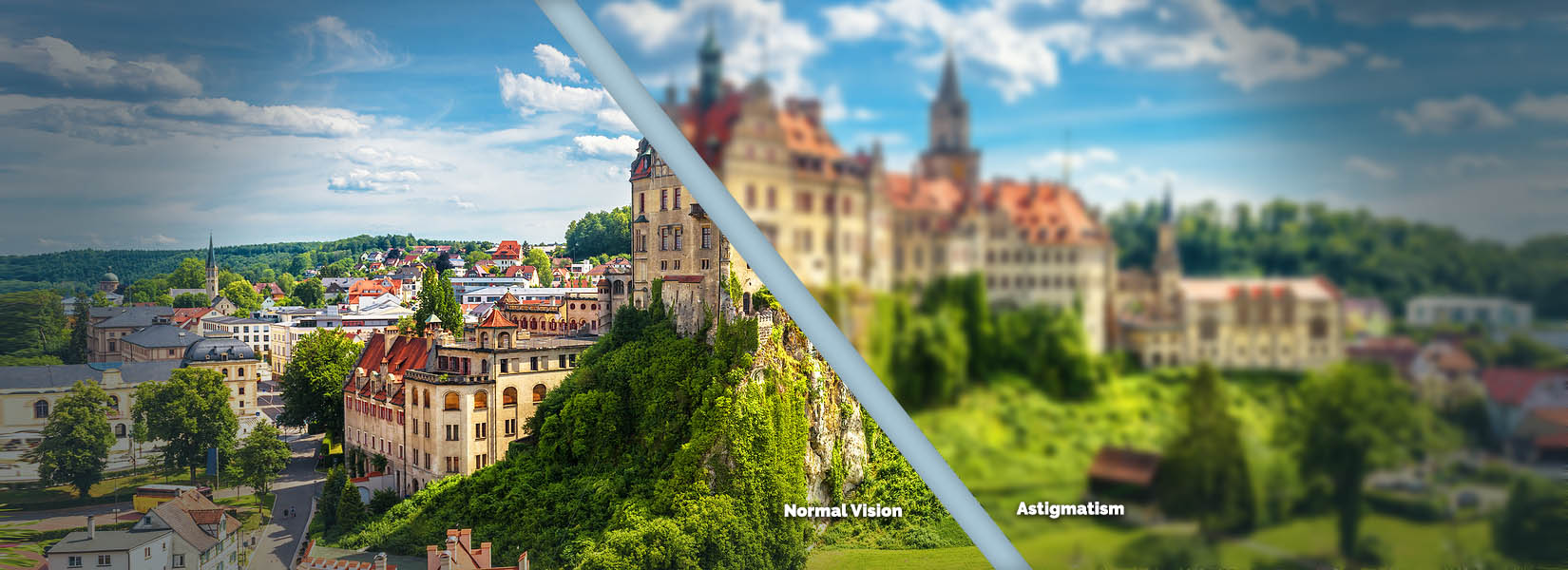 Astigmatism Treatment in Yardley