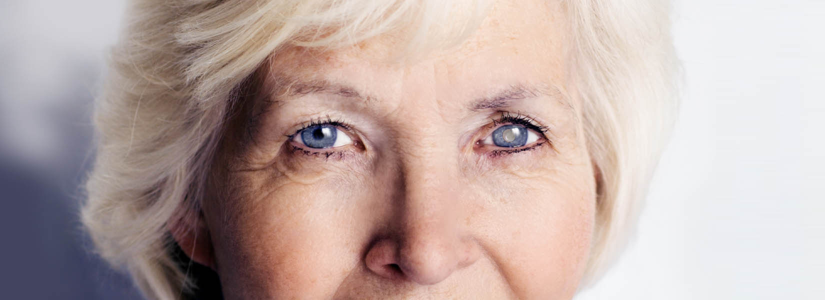 Cataract Surgery in Yardley